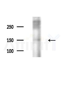 PCAF Antibody - Western blot analysis of extracts from HepG2 cells(starvation,24h treatment), using PCAF Antibody at 1/1000 dilution.