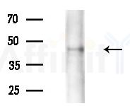 NAKED2 Antibody - Western blot analysis of extracts from Rat brain, using NAKED2 Antibody at 1/1000 dilution.