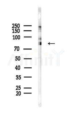 TPOR Antibody - Western blot analysis of lysates from COLO205 cells(heat-shock,45min treatment), using TPOR Antibody at 1/1000 dilution.