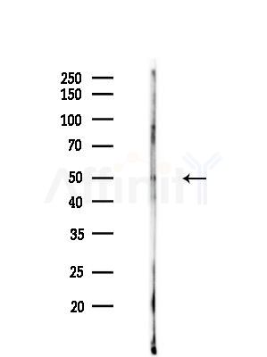 PSMC5 Antibody - Western blot analysis of lysates from HUVEC cellsLPS, using PSMC5 Antibody at 1/1000 dilution.
