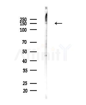 PLC beta 3 Antibody - Western blot analysis of lysates from B16F10-LUC cells(UV,30min treatment), using PLC beta 3 Antibody at 1/1000 dilution.