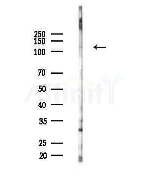 PLD1 Antibody - Western blot analysis of lysates from B16F10-LUC cells(UV,30min treatment), using PLD1 Antibody at 1/1000 dilution.