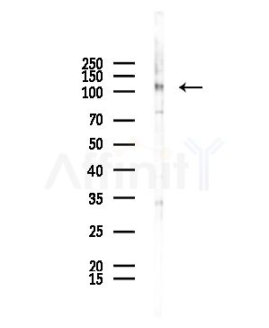 PPIG Antibody - Western blot analysis of lysates from HepG2 cells(starvation,24h treatment), using PPIG Antibody at 1/1000 dilution.