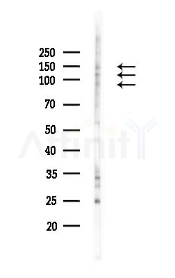 GKAP Antibody - Western blot analysis of lysates from MCF7 cells(heat-shock,45min treatment), using GKAP Antibody at 1/1000 dilution.
