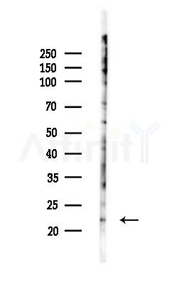 MOB1A Antibody - Western blot analysis of lysates from MCF7 cells(heat-shock,45min treatment), using MOB1A Antibody at 1/1000 dilution.