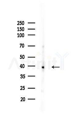 MERIT40 Antibody - Western blot analysis of lysates from MCF7 cells(heat-shock,45min treatment), using MERIT40 Antibody at 1/1000 dilution.