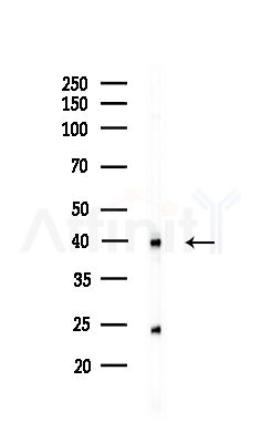 MERIT40 Antibody - Western blot analysis of lysates from COLO205 cells(UV,30min treatment), using MERIT40 Antibody at 1/1000 dilution.