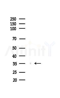 FosB Antibody - Western blot analysis of lysates from Rat liver, using FosB Antibody at 1/1000 dilution.