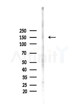 TSC1 Antibody - Western blot analysis of lysates from PC12 cells(heat-shock,45min treatment), using TSC1 Antibody at 1/1000 dilution.