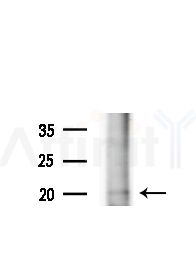IL5 Antibody - Western blot analysis of extracts from MCF7 cells(heat-shock,45min treatment), using IL5 Antibody at 1/1000 dilution.