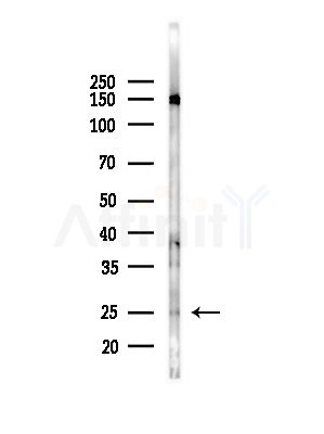 SIRT3 Antibody - Western blot analysis of lysates from Hela cells(heat-shock,45min treatment), using SIRT3 Antibody at 1/1000 dilution.