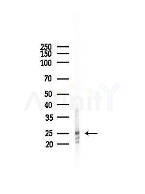 SIRT3 Antibody - Western blot analysis of lysates from Rat brain, using SIRT3 Antibody at 1/1000 dilution.