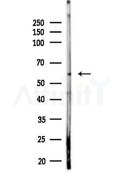 IL-2R beta/CD122 Antibody - Western blot analysis of lysates from Rat testis, using IL-2R beta/CD122 Antibody at 1/1000 dilution.