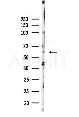 IL-2R beta/CD122 Antibody - Western blot analysis of lysates from HUVEC cells(UV,30min treatment), using IL-2R beta/CD122 Antibody at 1/1000 dilution.