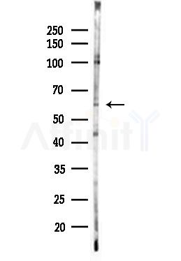 IL-2R beta/CD122 Antibody - Western blot analysis of lysates from Hela cells(starvation,24h treatment), using IL-2R beta/CD122 Antibody at 1/1000 dilution.