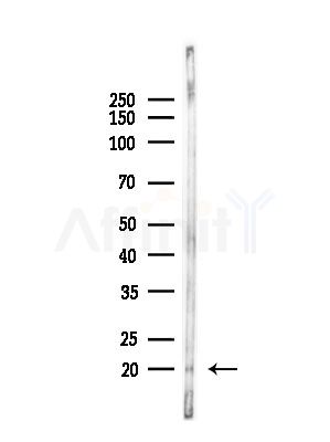 IL4 Antibody - Western blot analysis of lysates from LoVo cells(heat-shock,45min treatment), using IL4 Antibody at 1/1000 dilution.
