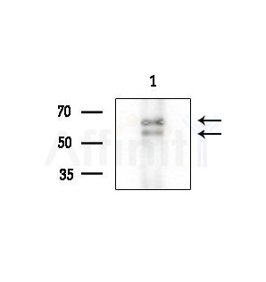 SMAD6 Antibody - Western blot analysis of extracts from COS-7 cells(heat-shock treatment), using SMAD6 Antibody at 1/1000 dilution.