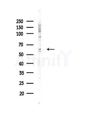 SMAD6 Antibody - Western blot analysis of lysates from COS-7 cells(heat-shock, 45min treatment), using SMAD6 Antibody at 1/1000 dilution.