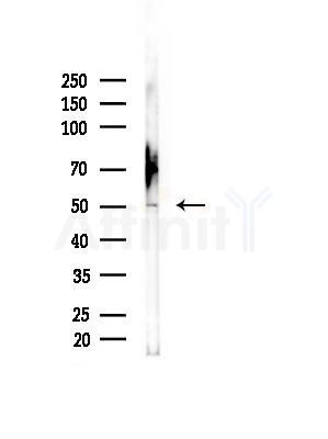 BMP5 Antibody - Western blot analysis of lysates from Rat brain, using BMP5 Antibody at 1/1000 dilution.