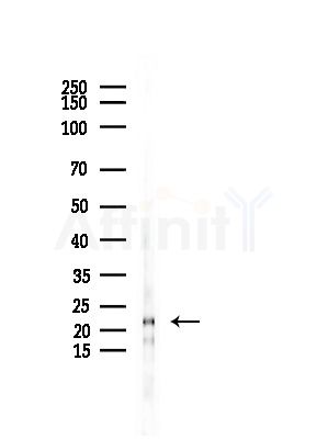 BBC3 Antibody - Western blot analysis of lysates from COLO205 cells, using BBC3 Antibody at 1/1000 dilution.
