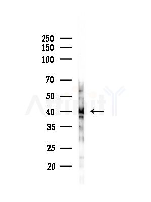 PAI 2 Antibody - Western blot analysis of lysates from HUVEC cells(starvation,24h treatment), using PAI 2 Antibody at 1/1000 dilution.