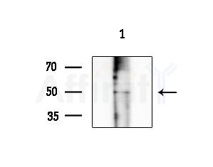 PAI 1 Antibody - Western blot analysis of extracts from PC12 cells(LPS 4h treatment), using PAI 1 Antibody at 1/1000 dilution.