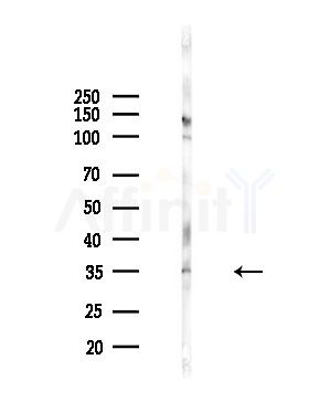 Cathepsin E Antibody - Western blot analysis of lysates from Hela cells(starvation,24h treatment), using Cathepsin E Antibody at 1/1000 dilution.