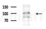 Integrin  alpha 3 Antibody - Western blot analysis of extracts from HepG2 cells(starvation treatment), using Integrin  alpha 3 Antibody at 1/1000 dilution.