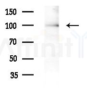 Integrin  alpha 3 Antibody - Western blot analysis of extracts from B16F10-HUC(heat-shock treatment), using Integrin  alpha 3 Antibody at 1/1000 dilution.