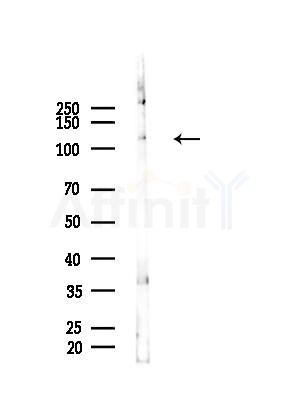 Integrin  alpha 3 Antibody - Western blot analysis of lysates from B16F10-HUC(heat-shock treatment), using Integrin  alpha 3 Antibody at 1/1000 dilution.