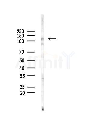 Integrin  alpha 3 Antibody - Western blot analysis of lysates from HepG2 cells(starvation treatment), using Integrin  alpha 3 Antibody at 1/1000 dilution.