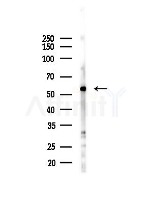 Angiopoietin 1 Antibody - Western blot analysis of lysates from Hela cells(heat-shock,45min treatment), using Angiopoietin 1 Antibody at 1/1000 dilution.