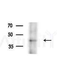 RUNX3 Antibody - Western blot analysis of extracts from A375 cells(heat-shock,45min treatment), using RUNX3 Antibody at 1/1000 dilution.