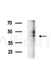 RUNX3 Antibody - Western blot analysis of extracts from Rat brain, using RUNX3 Antibody at 1/1000 dilution.