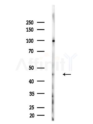 RUNX3 Antibody - Western blot analysis of lysates from A375 cells(heat-shock,45min treatment), using RUNX3 Antibody at 1/1000 dilution.