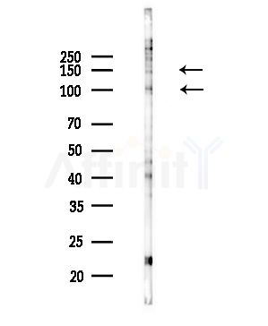 Integrin  alpha 5 Antibody - Western blot analysis of lysates from COLO205 cells(UV,30min treatment), using Integrin  alpha 5 Antibody at 1/1000 dilution.