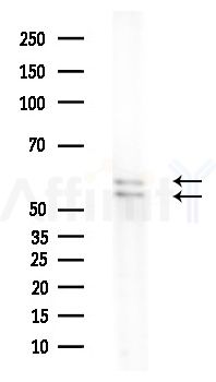 n-Myc Antibody - Western blot analysis of extracts from A375 cells(heat-shock treatment), using n-Myc Antibody at 1/1000 dilution.