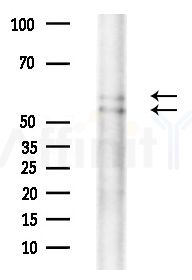 n-Myc Antibody - Western blot analysis of extracts from COLO205 cells(heat-shock treatment), using n-Myc Antibody at 1/1000 dilution.