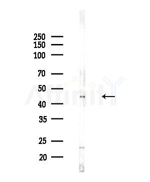 ESA Antibody - Western blot analysis of lysates from PC12 cells(LPS,4h treatment), using ESA Antibody at 1/1000 dilution.