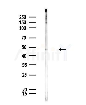 ESA Antibody - Western blot analysis of lysates from Rat lung, using ESA Antibody at 1/1000 dilution.