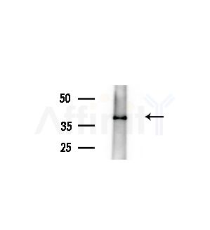 NCF1/p47-phox Antibody - Western blot analysis of extracts from A375 cells(heat-shock treatment), using NCF1/p47-phox Antibody at 1/1000 dilution.