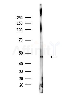 NCF1/p47-phox Antibody - Western blot analysis of lysates from A375 cells(heat-shock,45min treatment), using NCF1/p47-phox Antibody at 1/1000 dilution.