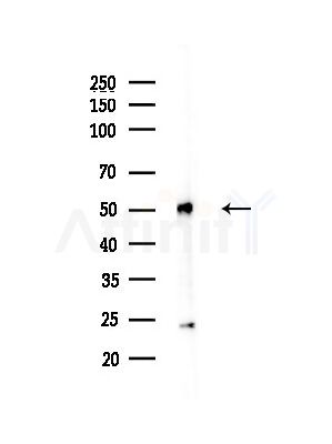 hnRNP H Antibody - Western blot analysis of lysates from Hela cells(heat-shock,45min treatment), using hnRNP H Antibody at 1/1000 dilution.