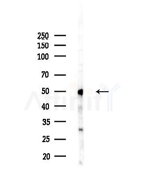 hnRNP H Antibody - Western blot analysis of lysates from LoVo cells(heat-shock, 45min treatment), using hnRNP H Antibody at 1/1000 dilution.