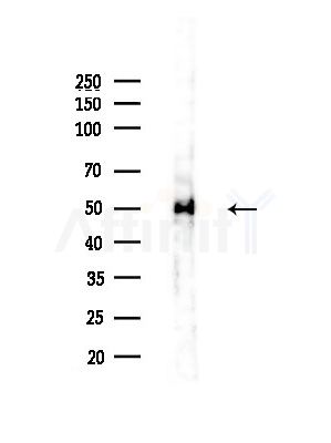 hnRNP H Antibody - Western blot analysis of lysates from Mouse brain, using hnRNP H Antibody at 1/1000 dilution.