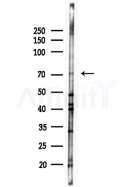 FSHR Antibody - Western blot analysis of lysates from HUVEC cells(UV,30min treatment), using FSHR Antibody at 1/1000 dilution.
