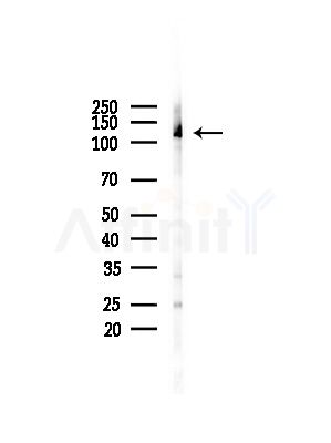 EPHB2 Antibody - Western blot analysis of lysates from Rat brain, using EPHB2 Antibody at 1/1000 dilution.