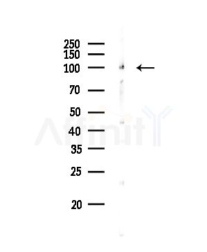 Actinin  alpha  2/3 Antibody - Western blot analysis of lysates from Rat brain, using Actinin  alpha  2/3 Antibody at 1/1000 dilution.