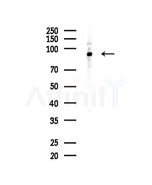 Actinin  alpha  2/3 Antibody - Western blot analysis of lysates from Mouse testis, using Actinin  alpha  2/3 Antibody at 1/1000 dilution.