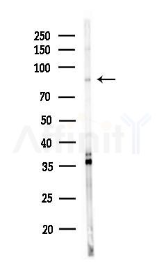 EZH1 Antibody - Western blot analysis of lysates from MDA-MB-231 cells(heat-shock,45min treatment), using EZH1 Antibody at 1/1000 dilution.